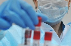 Новых случаев заболевания коронавирусом на Кубани не выявлено