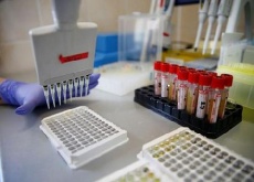 Общее число подтвержденных случаев коронавируса на Кубани превысило 1,5 тысячи